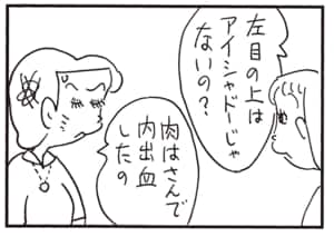 左目の上はアイシャドーじゃないの？　肉はさんで内出血したの